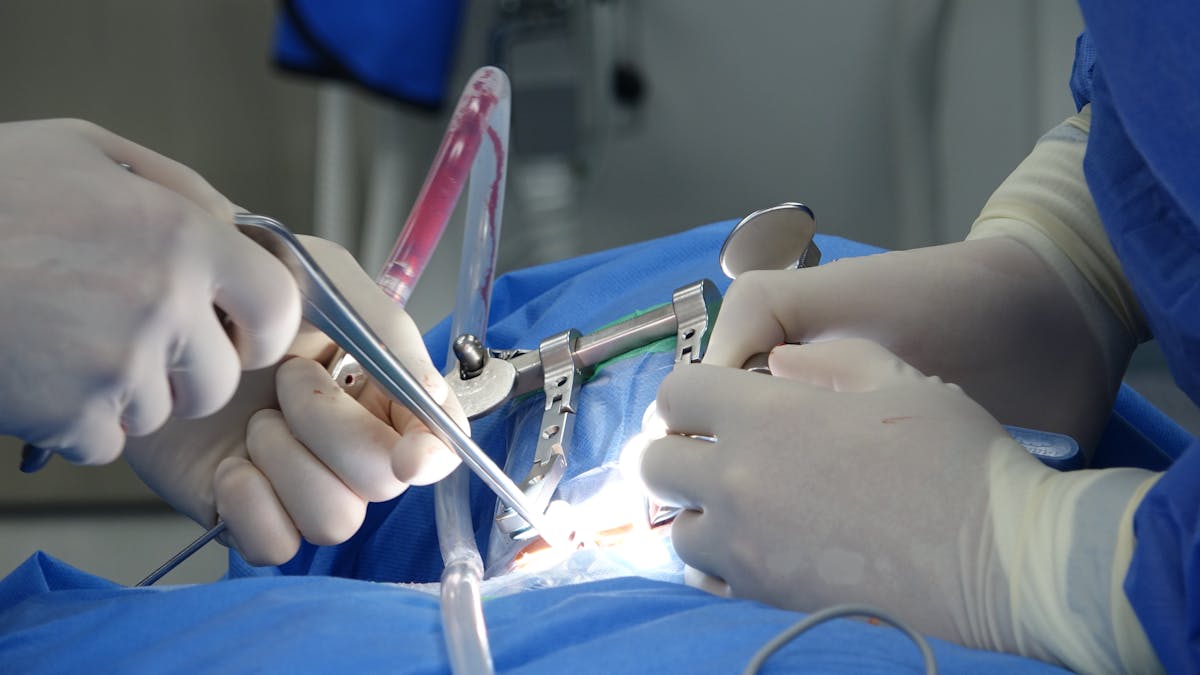 Spinal surgery with patient-specific implant in place